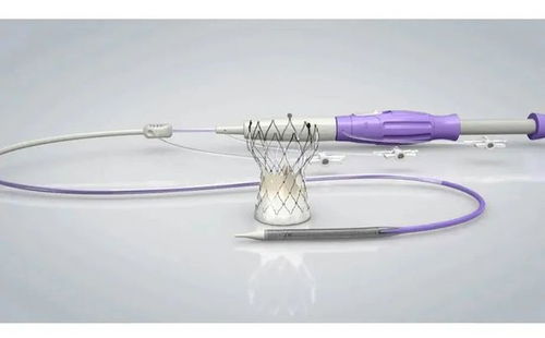 2021年园区5款创新医疗器械产品获批上市，占全省71%